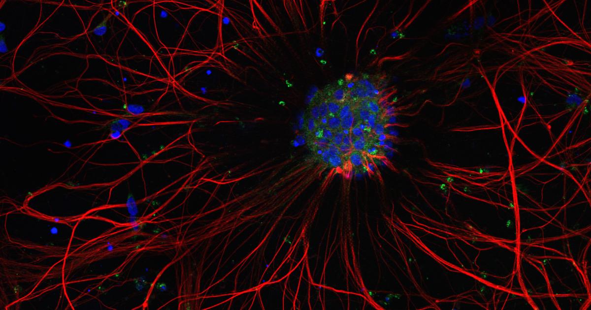 Qanday qilib birovni eshakda sikish uchun