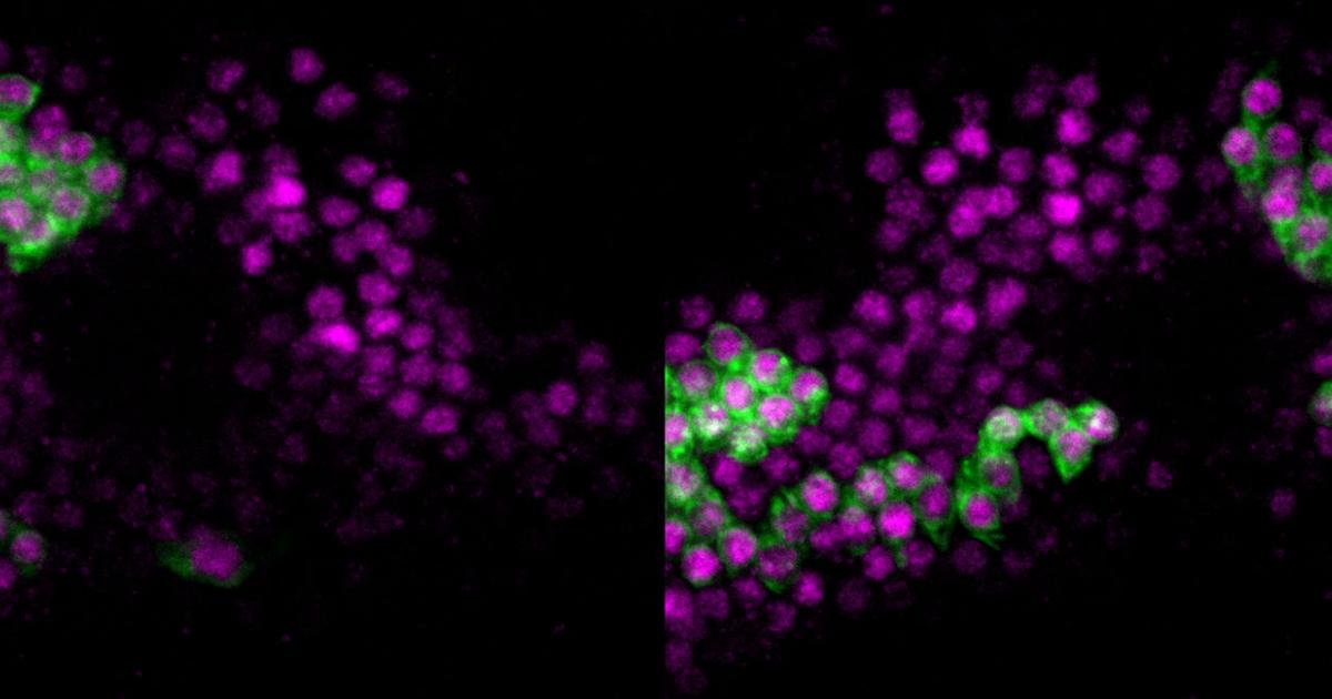洋書 MORPHOGENESIS From morphogen to morphogenesis and back | Nature