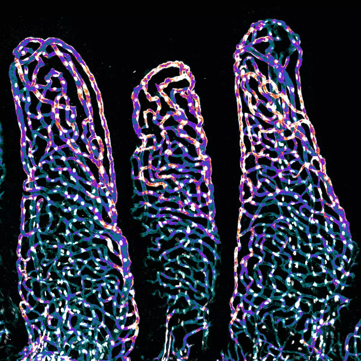 Mouse intestinal villi vasculature, Photo credit: Satu Paavonsalo