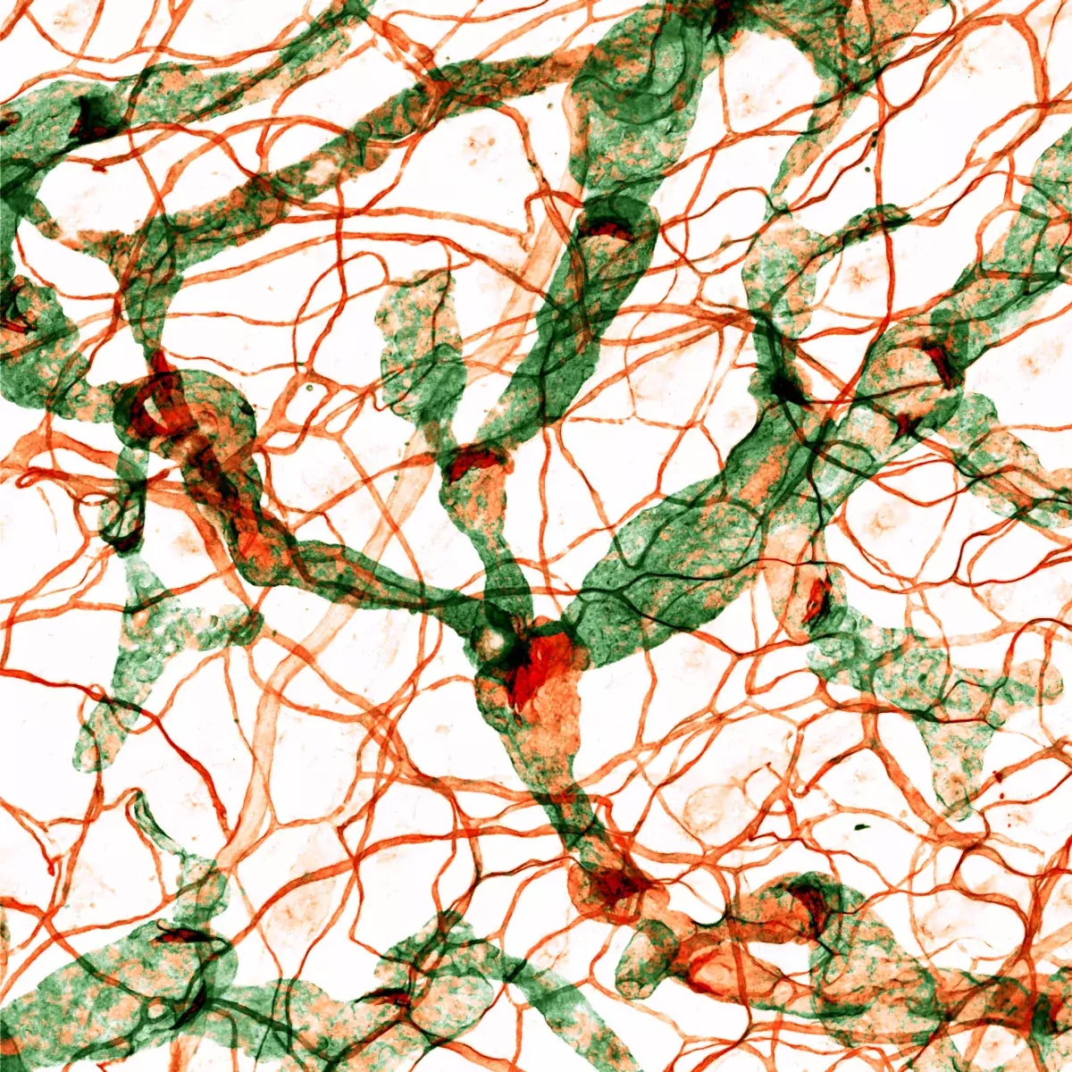 Mouse ear skin vasculature, Photo credit: Satu Paavonsalo