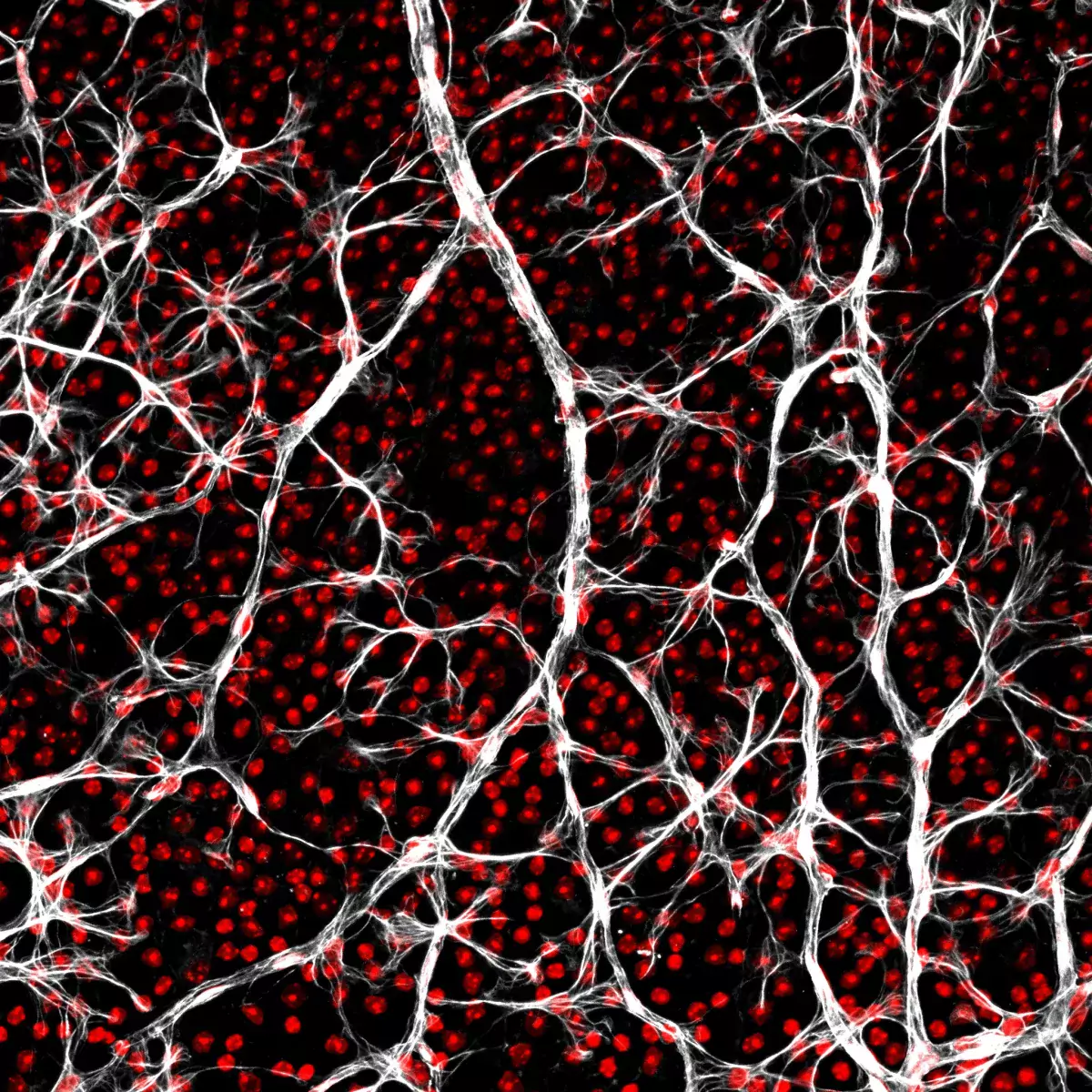Mouse retina vasculature and astrocytes, Photo credit: Sinem Karaman