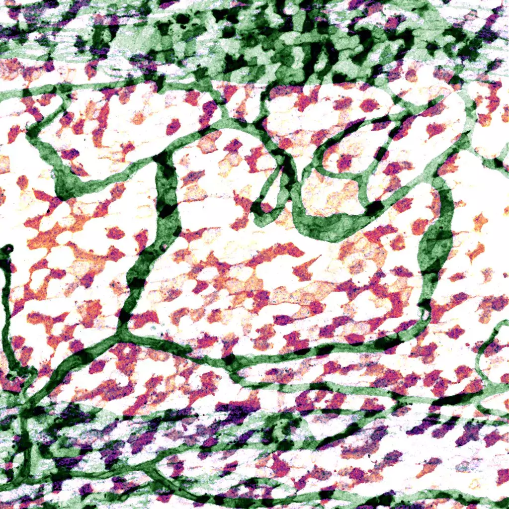 Mouse trachea, Photo credit: Satu Paavonsalo