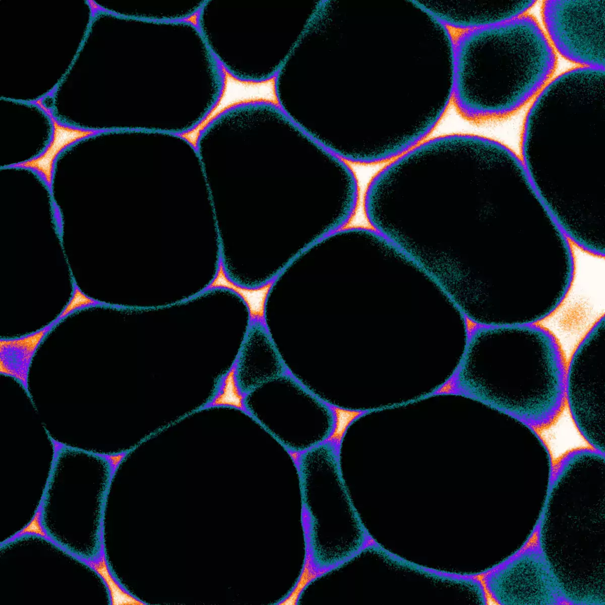 Mouse white adipose tissue, Photo credit: Satu Paavonsalo