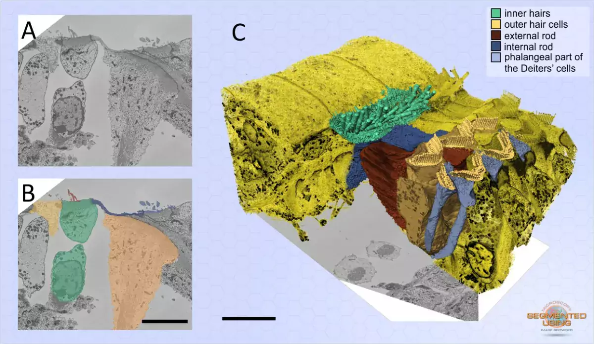 Mouse cochlea was perilymphatically fixed and the sensory epithelium of the medial part of the cochlear duct was imaged.