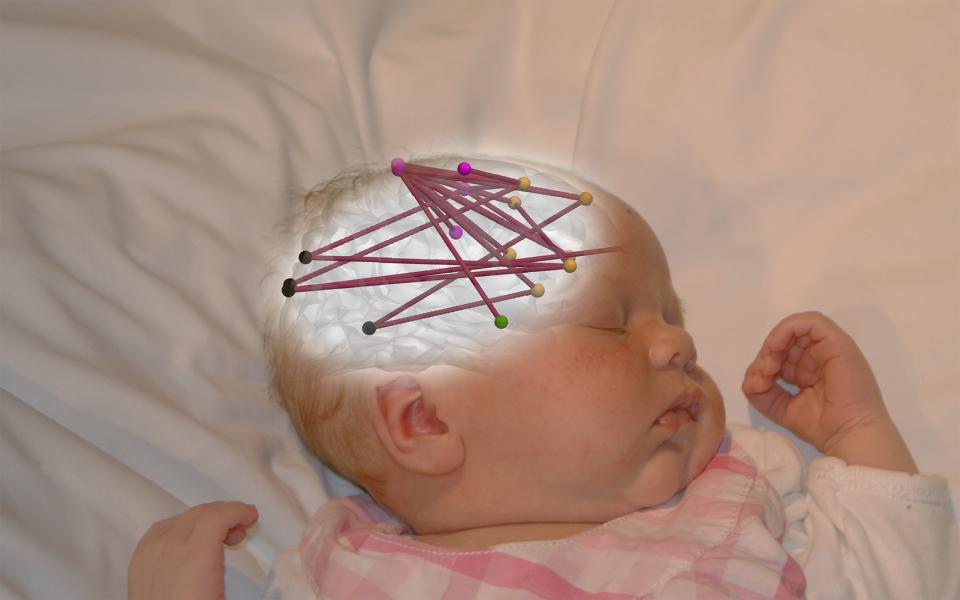 Kuva vauvan päästä, johon piirrosohjelmalla kuvattu vauvan aivokuoren hermoverkostoja.